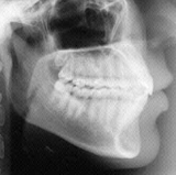 Radiologia Odontológica em Campina Grande
